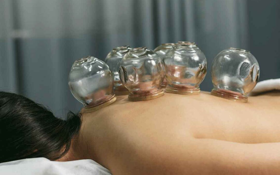 Cupping & Quasha – En rejse til dyb afslapning og fornyet energi