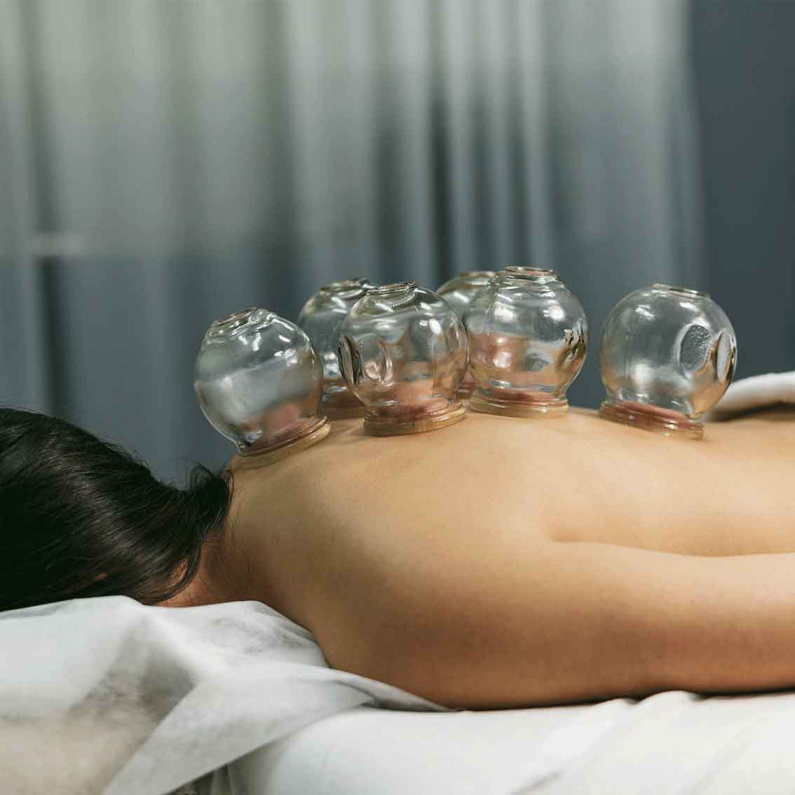 Cupping-Quasha-Behandling-blog